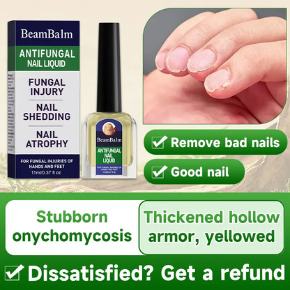 Maximum Strength Comprehensive Toenail Fungus Solution | Triple Action Formula Fights Fungus, Clears Yellow & Thick Nails, Fast Itch Relief.#DealsForYouDays