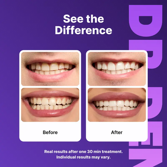 Teeth Whitening Strips – Peroxide-Free 30-Minute Whitening Kit, 14 Strips, Vegan Easy Peel-Off Formula