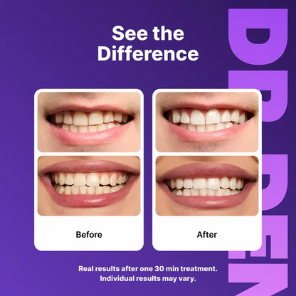 Teeth Whitening Strips – Peroxide-Free 30-Minute Whitening Kit, 14 Strips, Vegan Easy Peel-Off Formula