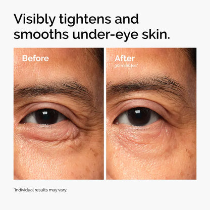 Lacto-PDRN* 4% + B9 Eye Cream