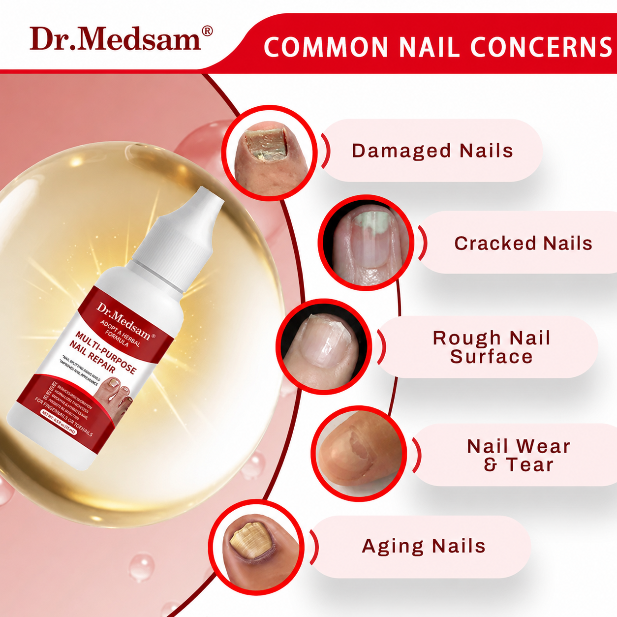 Extra Strength Toenail Fungus Treatment, Antifungal Solution for Toenails & Fingernails, Triple Action Formula to Remove Fungus, Repair Damaged Nails, 0.5 Fl Oz Healing Natural Therapeutic Nail Care