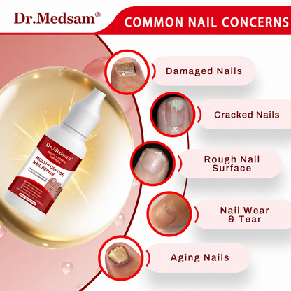 Extra Strength Toenail Fungus Treatment, Antifungal Solution for Toenails & Fingernails, Triple Action Formula to Remove Fungus, Repair Damaged Nails, 0.5 Fl Oz Healing Natural Therapeutic Nail Care