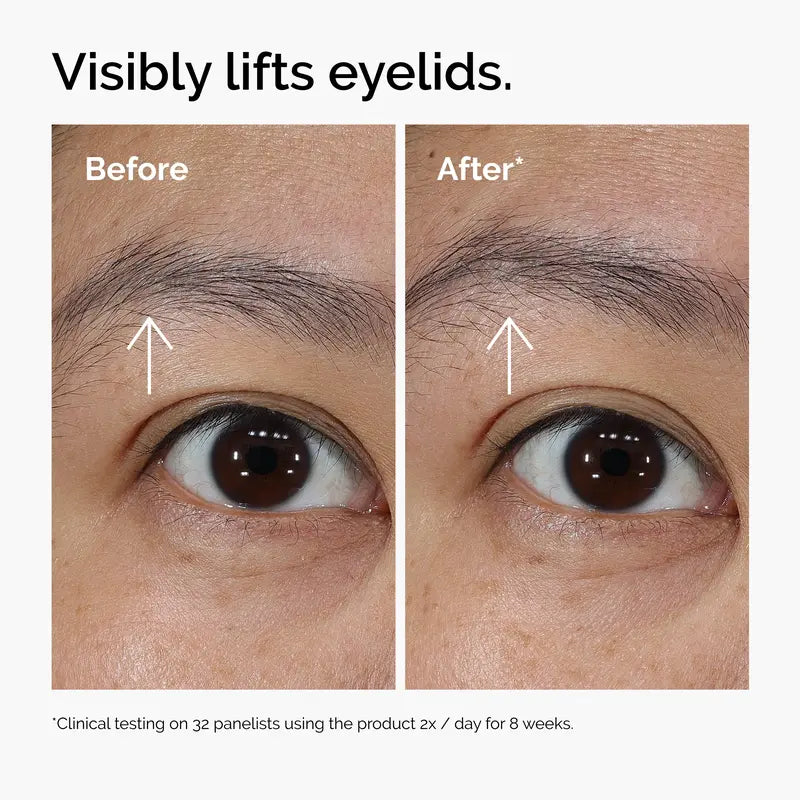 Lacto-PDRN* 4% + B9 Eye Cream